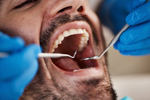 Best Root Canal Emergency Dentist  in Altamont, KS