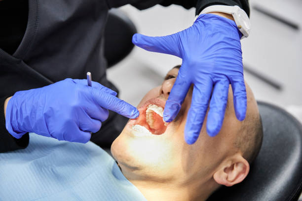 Teeth Whitening in KS